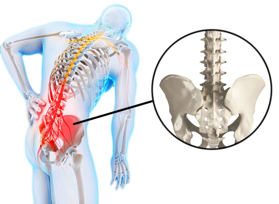 Spine pathologies are a common cause of low back pain. 