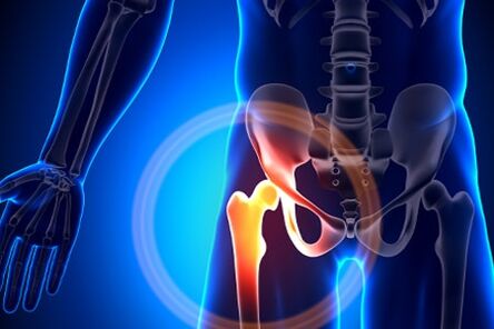 Hip joint pain