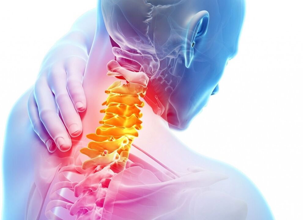 What is cervical osteochondrosis