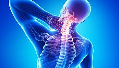Complications of the osteochondrosis of the cervical column