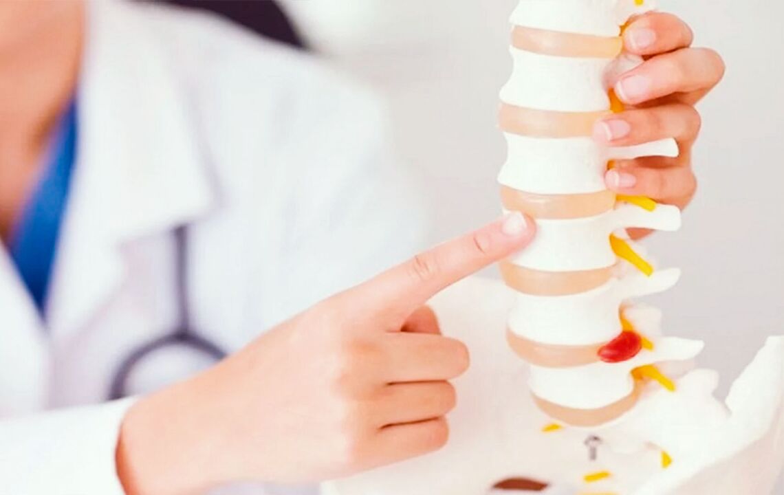 Damage to the spine due to cervical osteochondrosis.