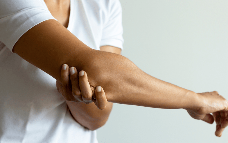 Obvious symptoms of osteoarthritis of the hands.